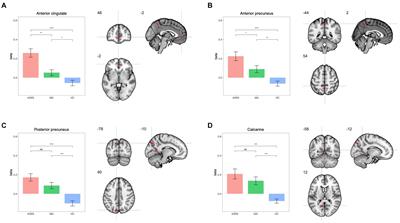 Neuroimaging markers of Alice in Wonderland syndrome in patients with migraine with aura